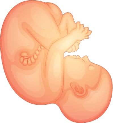 What is torch disease?