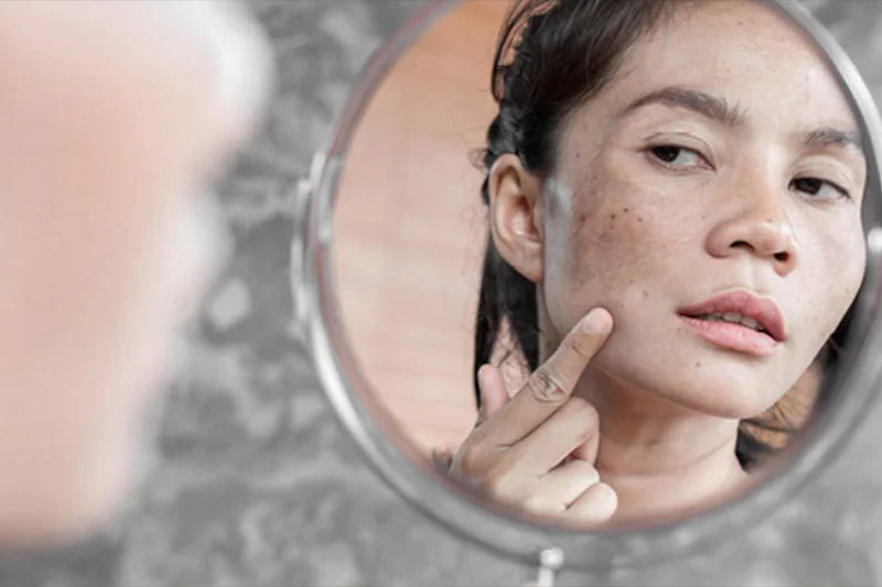 The Natural Depigmentation Protocol: A Reader’s Guide to Melanopro-Inspired Results