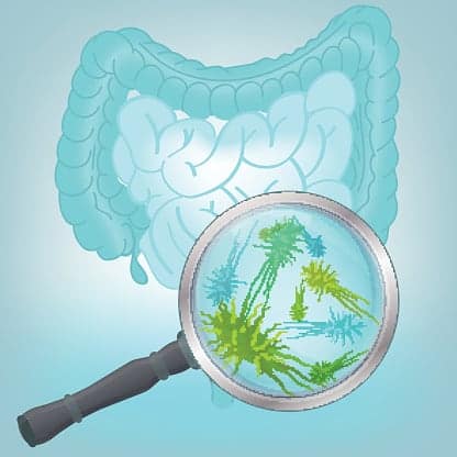 What you need to know about your colon
