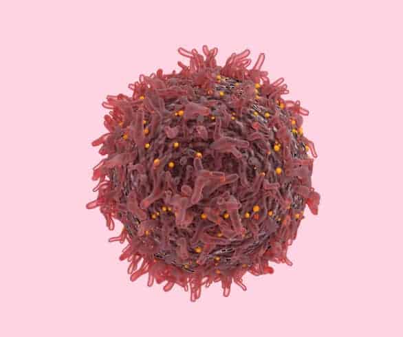 Could immunotherapy cure brain cancer?