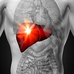 Bile pigment may help protect against heart attacks