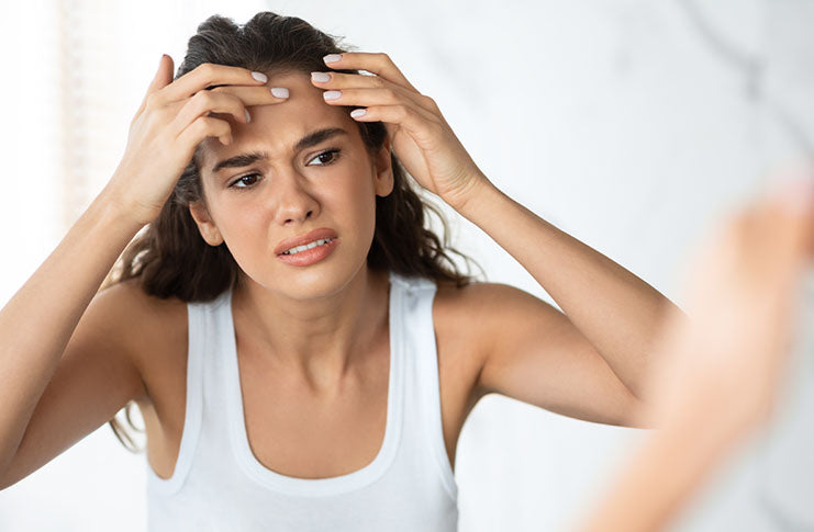B Vitamins And Acne