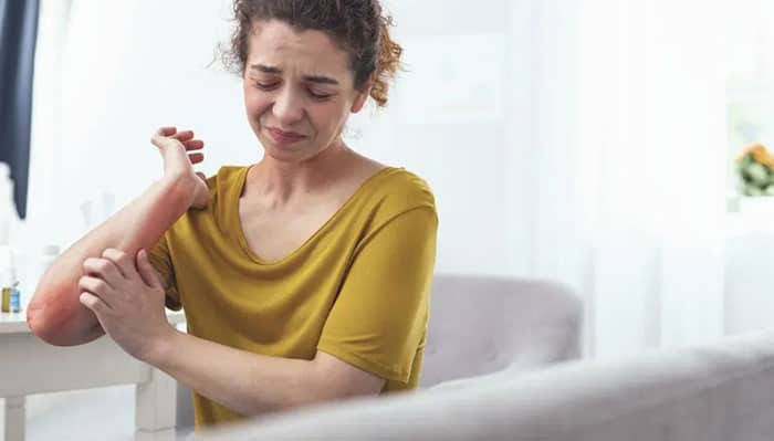 A new drug could improve dermatitis after a single dose