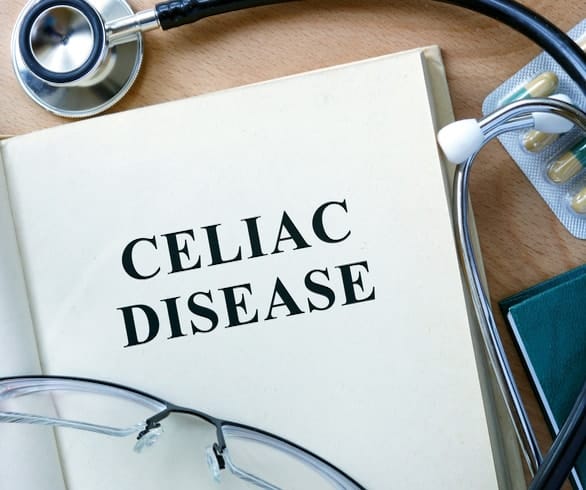Can celiac disease be treated holistically?