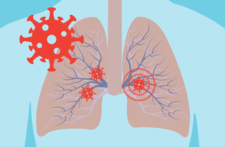 Organ Transplants in Peril as COVID-damaged Organs
