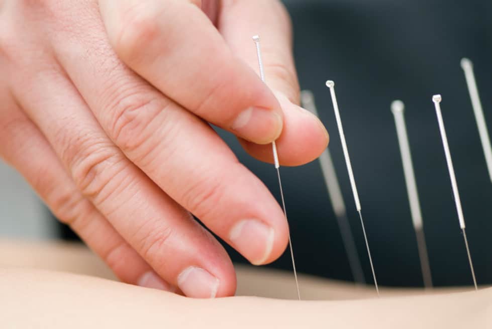 What is chinese medicine?