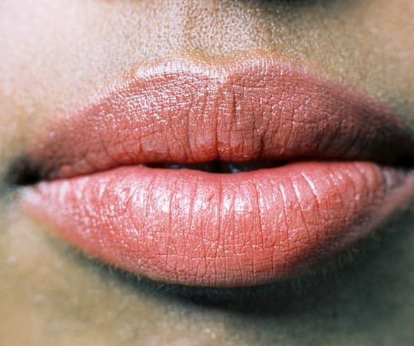 Say goodbye to cold sores with these DIY remedies