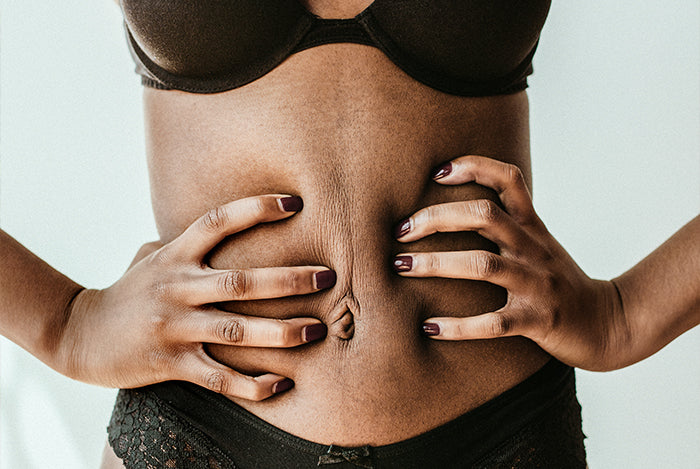 Improve Your Posture to Lose Belly Fat