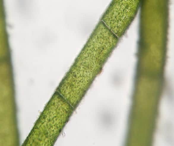 Is phytoplankton the next superfood?