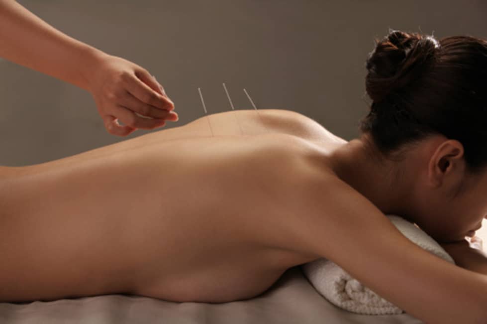 What is Acupuncture?